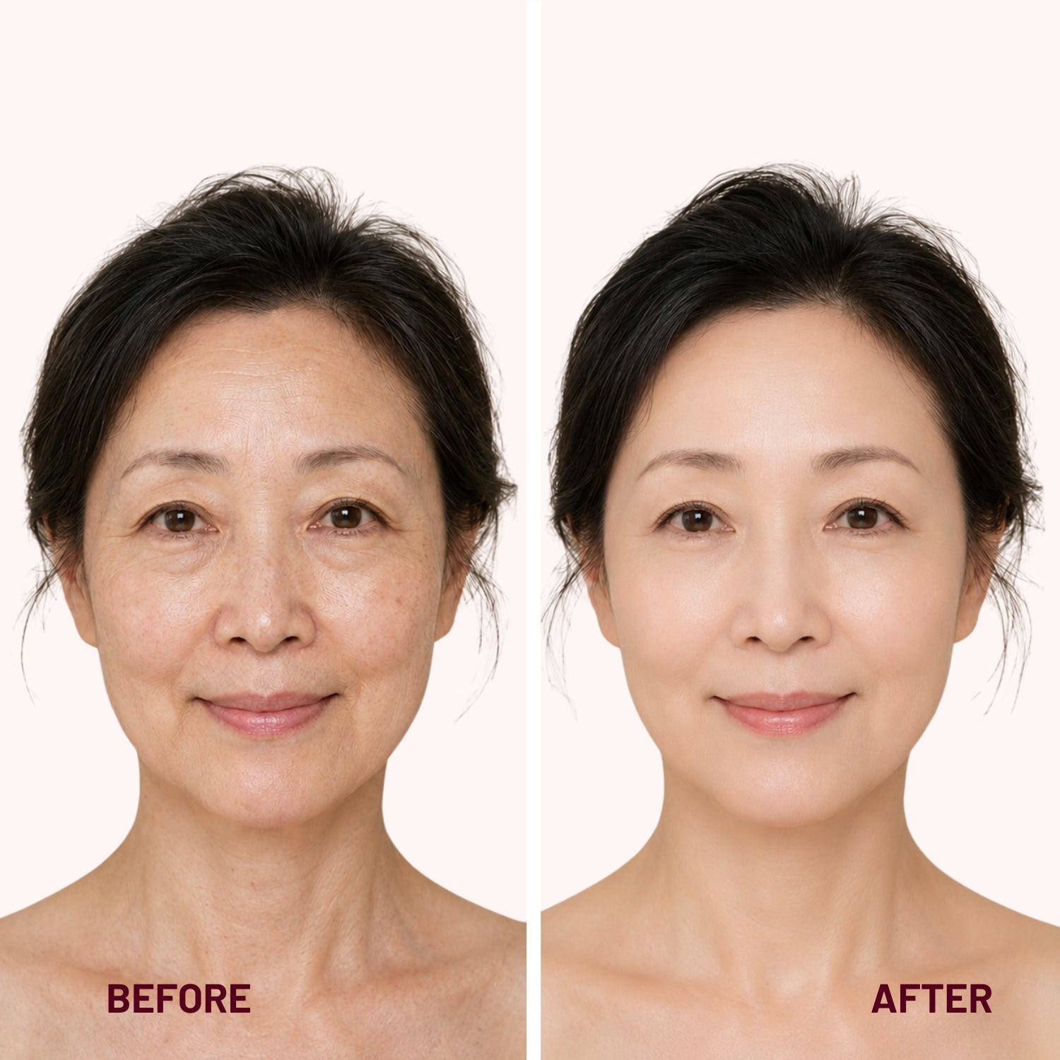 Reverse-aging Adaptive Foundation