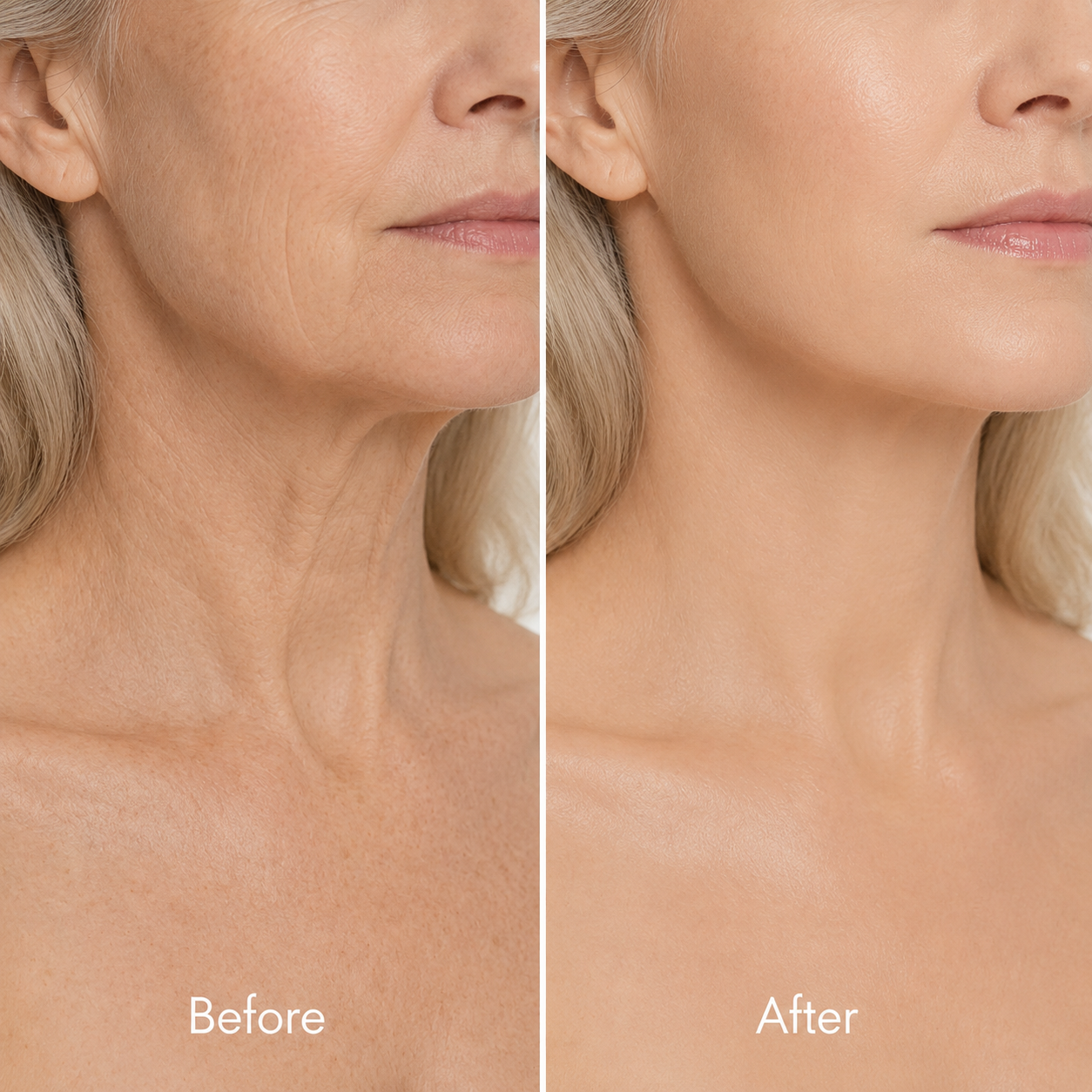 5. Fixes crepey neck skin